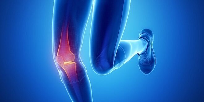 Cara Mengobati Cedera Ligamen Lutut dan Efeknya