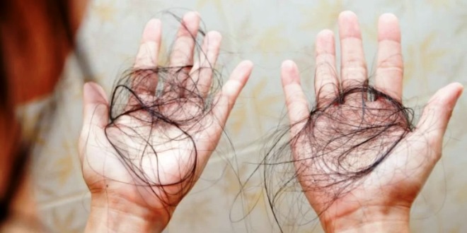 Mengenal Perbedaan Hair Fall dan Hair Loss Masalah Rambut Rontok yang Sering Terjadi