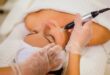 Harga Laser Wajah di Klinik Kecantikan Terbaru, Cara Kerja, Manfaat dan Efek Samping